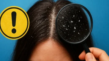 Sonhar com caspa no cabelo: autoimagem, cuidado e alerta