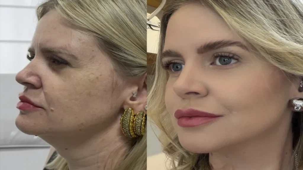 Estética regenerativa: o novo luxo em rejuvenescimento natural