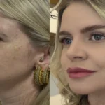 Estética regenerativa: o novo luxo em rejuvenescimento natural