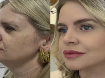 Estética regenerativa: o novo luxo em rejuvenescimento natural