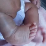 Mãe luta contra o tempo para tratar pé torto de filha após parto
