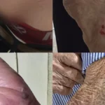 Idoso de 87 anos é derrubado e mordido por cão na Vila Nasser