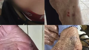 Idoso de 87 anos é derrubado e mordido por cão na Vila Nasser