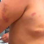 Mãe de menina autista agredida defende padrasto em áudio