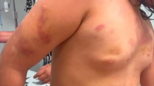 Mãe de menina autista agredida defende padrasto em áudio